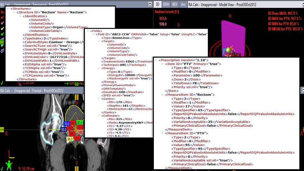 Webinars Revisited: Automated Treatment Planning from Templates