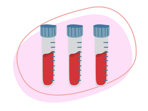 Can Blood Test Results Vary Between Different Laboratories?