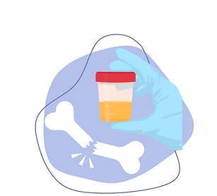 Crosslaps (CTX-1) (Urine)