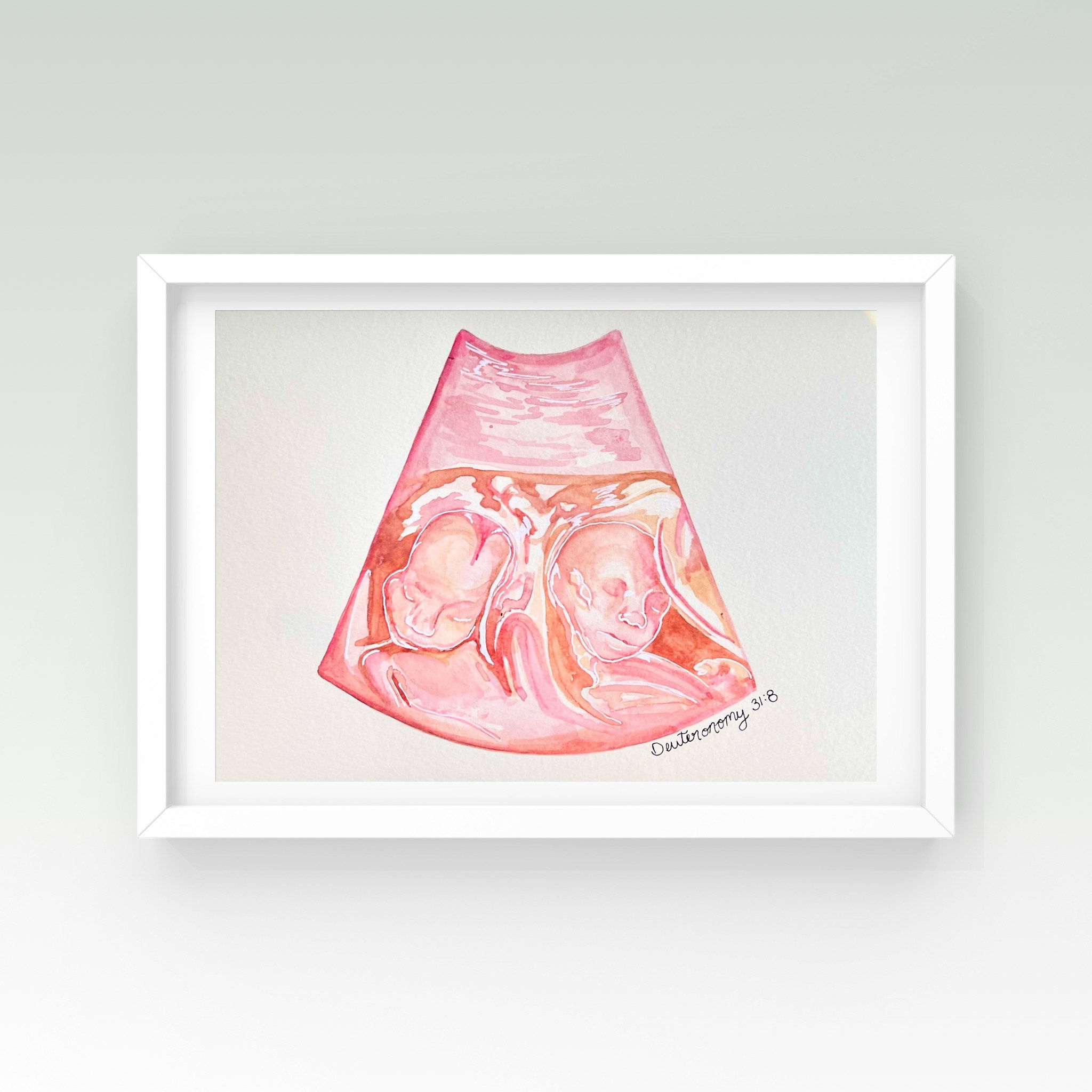 5x7 Unframed Ultrasound Watercolor Painting