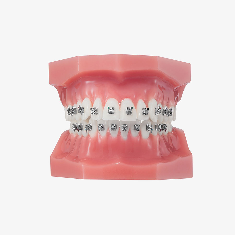 Briketa metalike YES Bracket ROTH 022 Set