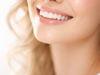 Blanchiment dentaire Lyon : une touche d’éclat pour votre sourire