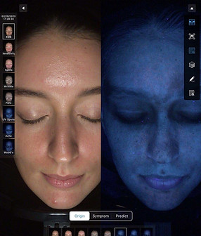 61e4322b11644542d48ca562_app UV spots_edited.jpg