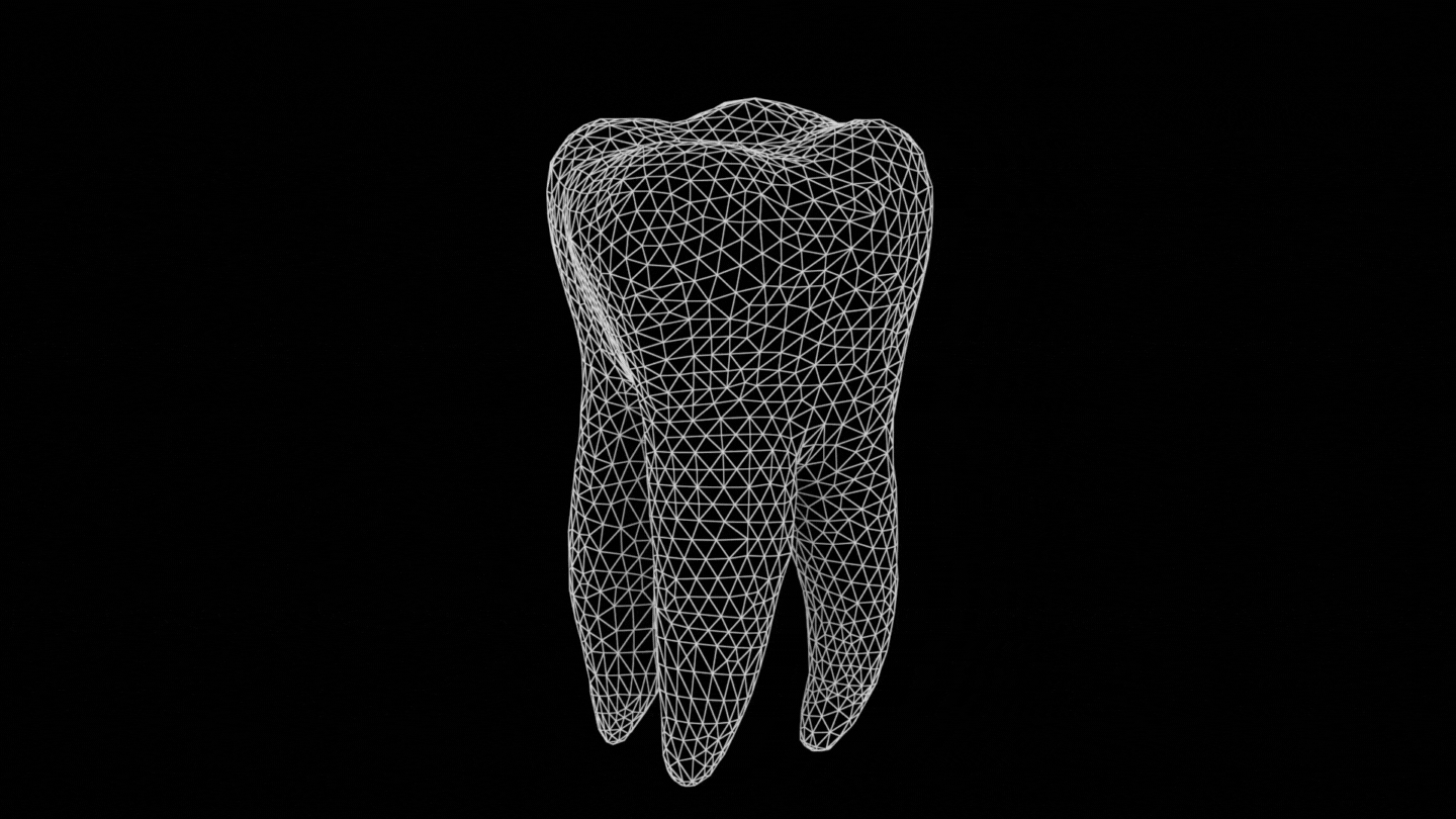 3D tooth.gif