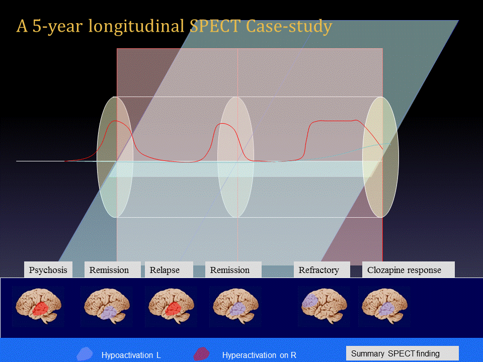 Slide1.GIF