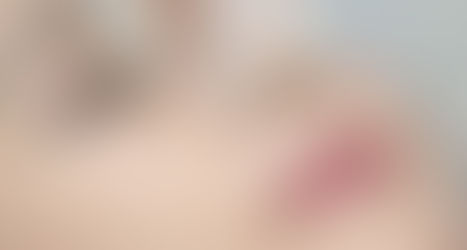 Nang mui bang chi collagen - Lam moi ve dep hien dai