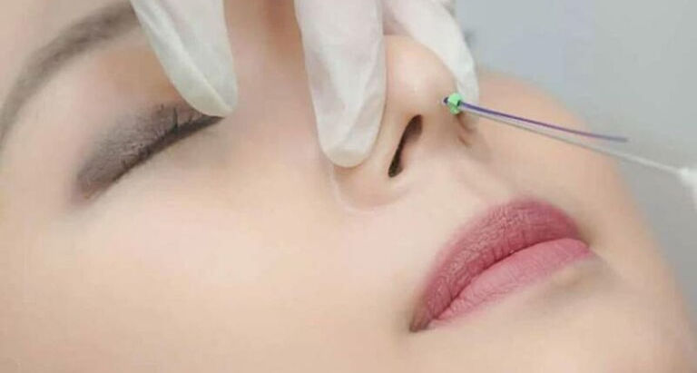 Nang mui bang chi collagen - Lam moi ve dep hien dai