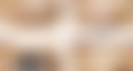 Tim hieu ve phuong phap nhan mi Han Quoc va nhung thac mac lien quan