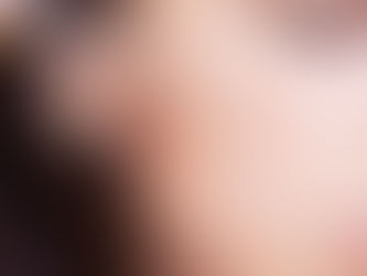 Salicylic acid là gì? Công dụng và các lưu ý khi sử dụng trên da