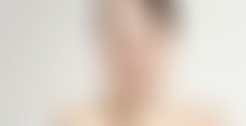 Các bước skincare cho da dầu mụn ẩn đúng cách ngay tại nhà