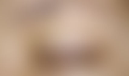 Qua trinh sinh hoat va ve sinh vet thuong sau cat mi