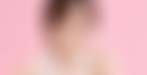 Quy Trình Bấm Mí Dove Eyes Chuẩn Bệnh Viện Thẩm Mỹ