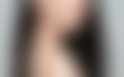 Mách nhỏ bạn 9 mẹo trị nám sau sinh cực kỳ hiệu quả