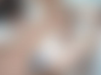 Có nên triệt lông không? Tìm hiểu kỹ trước khi quyết định