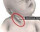 musculo.jpg