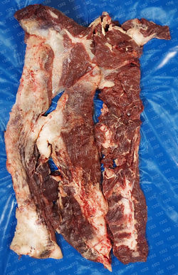NECK - COGOTE