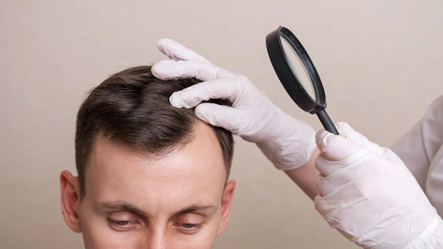 hair loss treatment vancouver-3.webp