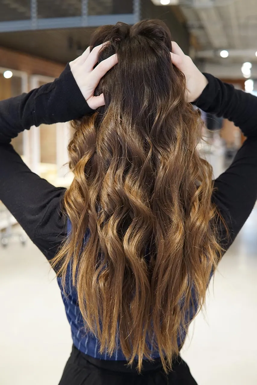 hair loss specialist vancouver