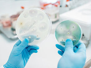 Studien zeigen: Die Antibiotika-Resistenz vieler Keime ist viel verbreiteter als bisher angenommen