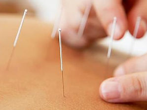 insertion of acupuncture needles