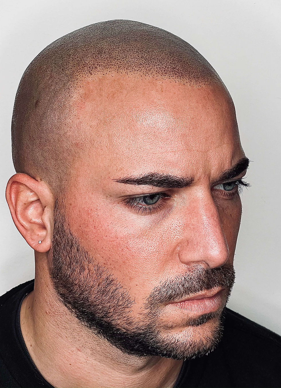 Micropigmentation capillaire Bruxelles