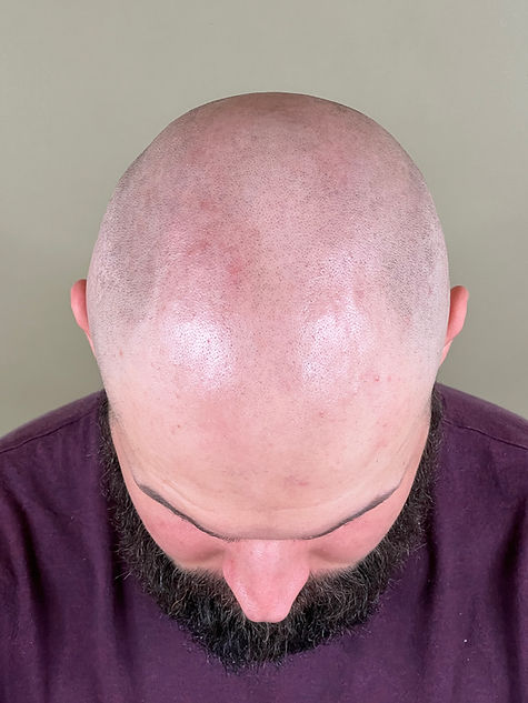 Micropigmentation effet rasé Bruxelles