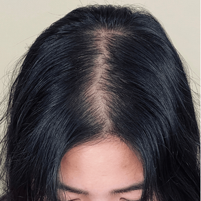 Micropigmentation effet densité chez la Femme