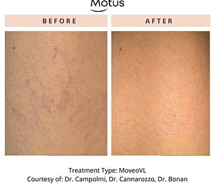 Motus3168970869123.png