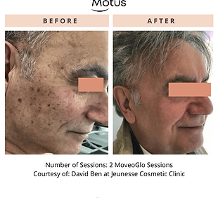 MotusAZ5168970930598.png