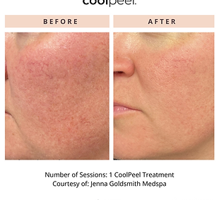 CoolPeel17170126935362.png