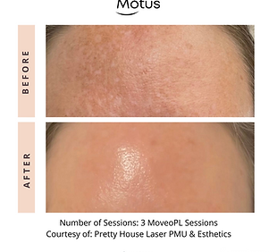 Motus10168970869491.png