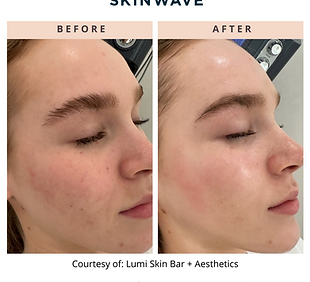 LumiSkinBarSkinwave2169108115062.png