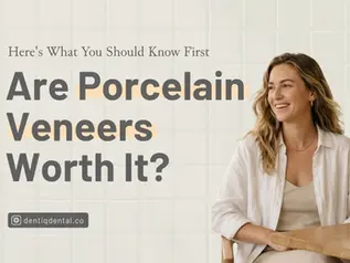 Porcelain Veneers in Canggu, Bali: Benefits, Procedure & Cost Guide