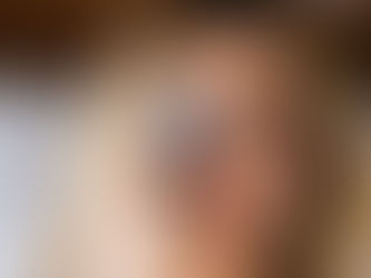 Prevenção do câncer de pele: dermatoscópio e consulta anual em Itajaí