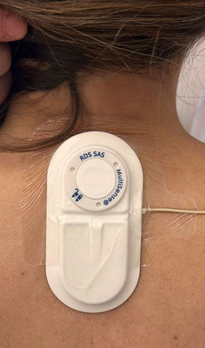 Sortie précoce après colectomie