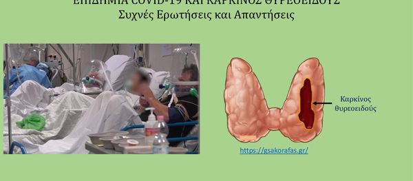 Καρκίνος θυρεοειδούς και κορονοϊός (COVID-19) – ερωτήσεις και απαντήσεις