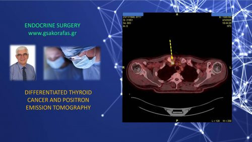 Positron emission tomography and differentiated thyroid cancer