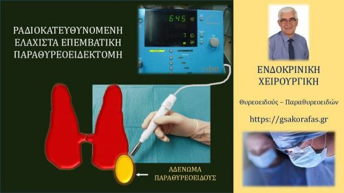 Πρωτοπαθής υπερπαραθυρεοειδισμός - Ραδιοκαθοδηγούμενη ελάχιστα επεμβατική παραθυρεοειδεκτομή
