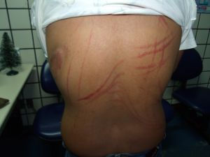 Mulher é agredida com fio elétrico; marido foi preso