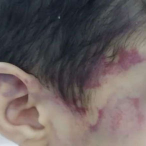 Urgente: Lutador agrediu menino de 5 anos porque ele não pegou papel higiênico