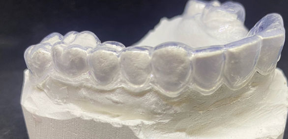 Een bleeklepel dient om tanden een lichtere kleur te geven.