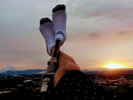 ¿Qué es el síndrome del Miembro Fantasma?