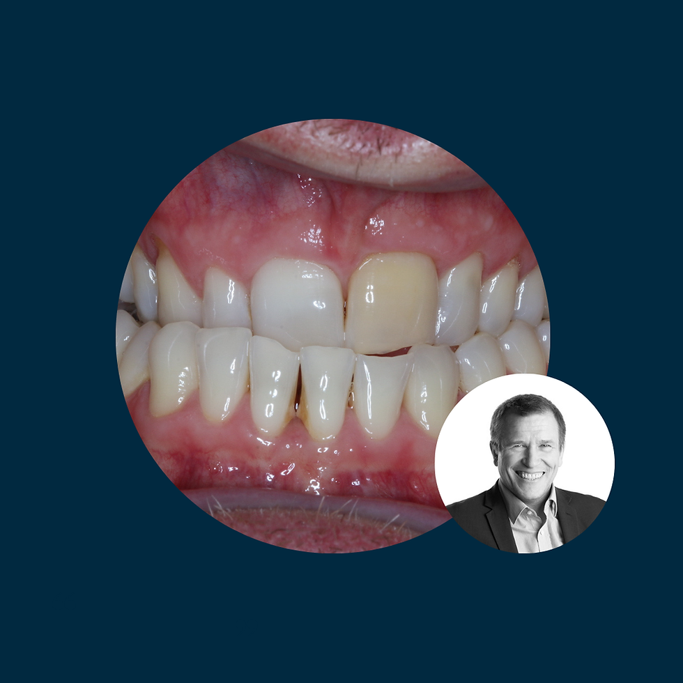 Dr. Ian Buckle - Mastering Complex Cases with Complete Occlusion and Digital Workflows - 30th-31st Oct - Copenhagen