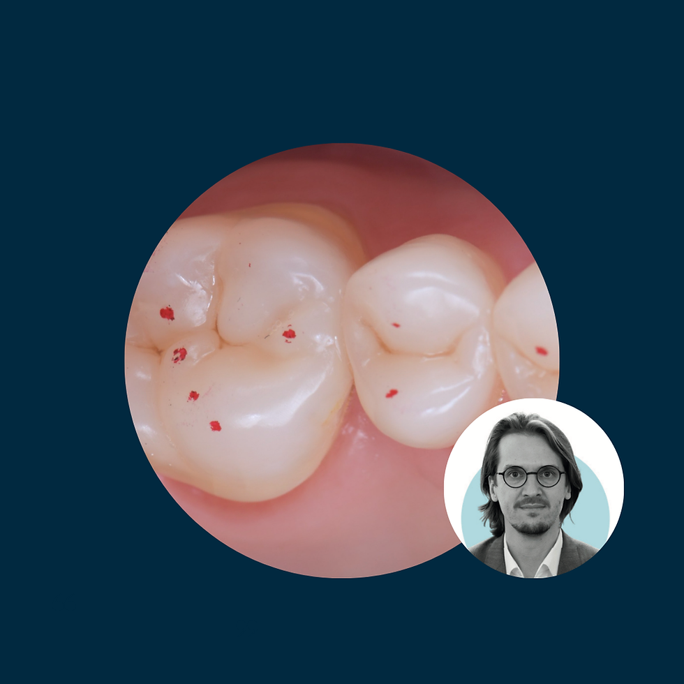 Increasing and stabilising vertical dimension of occlusion - Hands-on - 6th of Nov - CPH