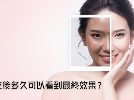 透明質酸填充後多久可以看到最終效果?