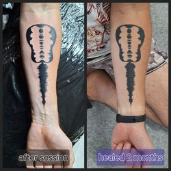 Healed Blackwork arm