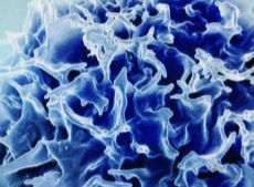 Schwächung des Immunsystem im Alter ist umkehrbar