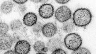 Hantavirus: Aargauer Crewmitglied des betroffenen Kreuzfahrtschiffes repatriiert