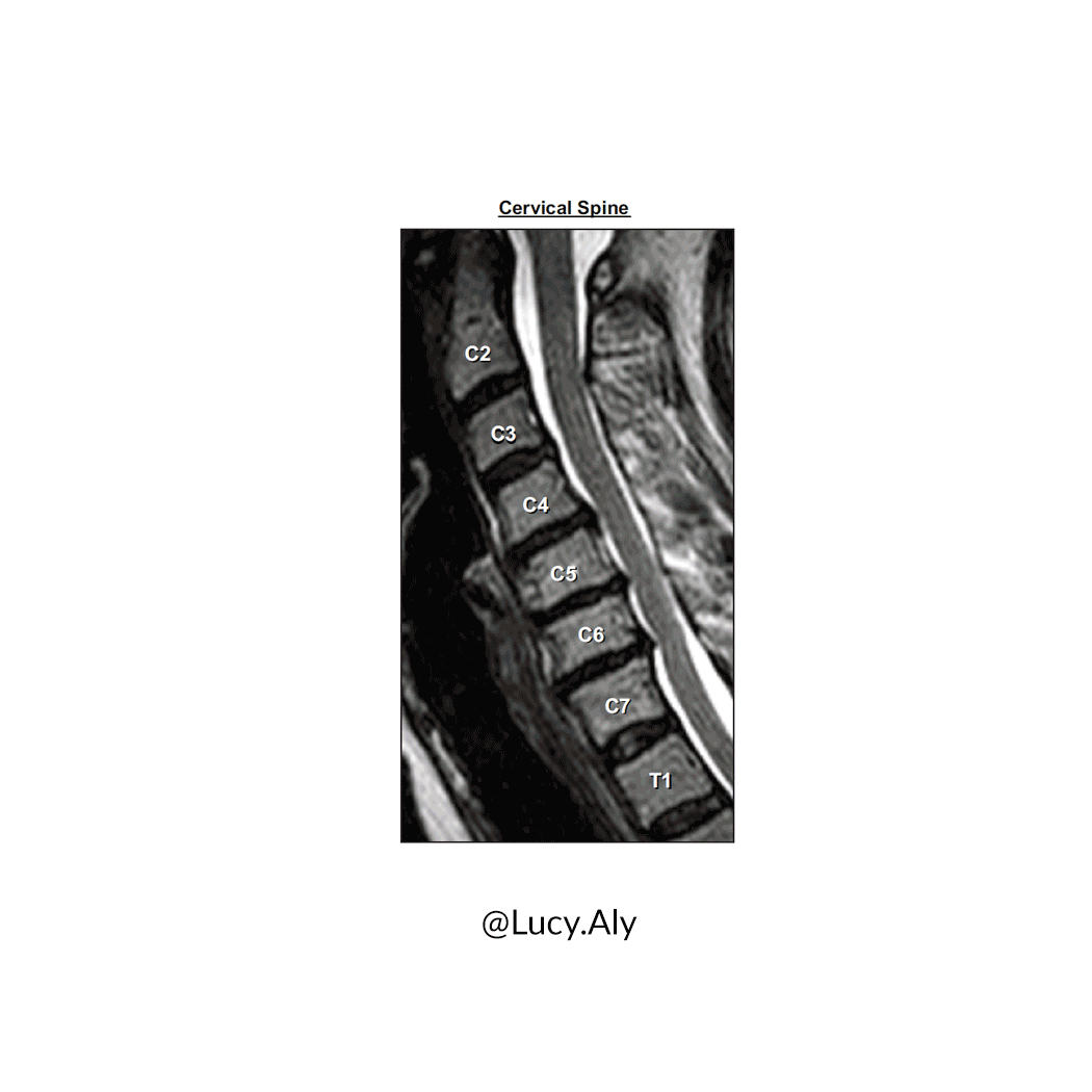 Lucy-Aly_GIF_Cervical-Spine-Disc-Herniations-Illustration.gif