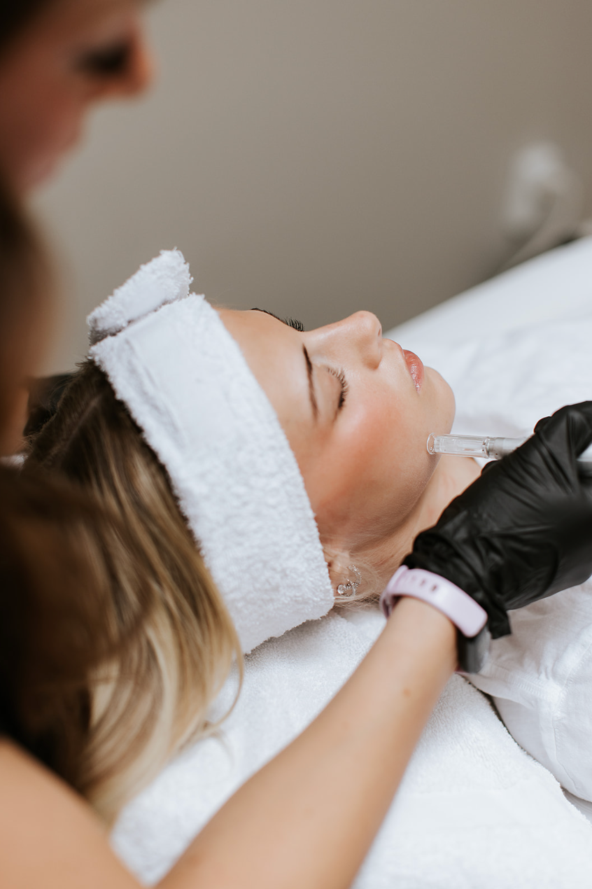 Microneedling Skin Dynamics Cranbrook.png